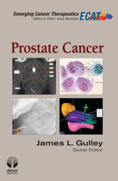 Image of - Prostate Cancer | Hardcover