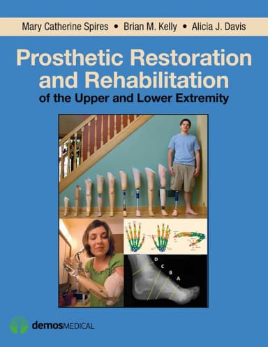 Image of - Prosthetic Restoration and Rehabiliation of the Upper and Lower Extremity | Hardcover