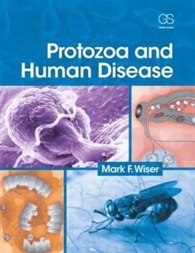 Image of - Protozoa and Human Disease | Paperback
