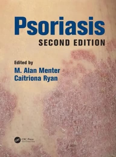 Image of - Psoriasis | 2nd Edition | Hardcover