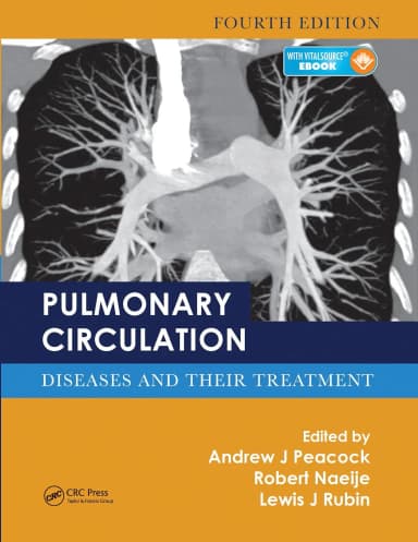 Image of - Pulmonary Circulation Diseases And Their Treatment 4th Edition | Paperback