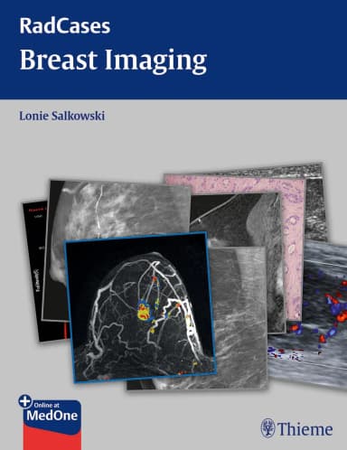 Image of - RadCases Breast Imaging | Paperback