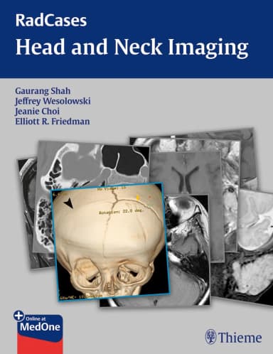 Image of - RadCases Head and Neck Imaging | Paperback