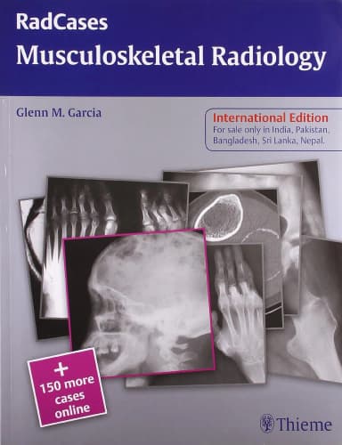 Image of - RadCases Musculoskeletal Radiology
