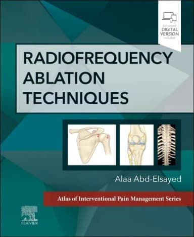 Image of - Radiofrequency Ablation Techniques With Access Code | Hardcover