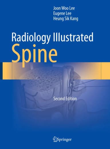 Image of - Radiology Illustrated Spine 2nd Edition | Hardcover
