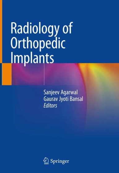 Image of - Radiology of Orthopedic Implants | Hardcover
