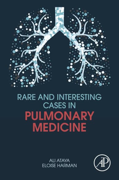Image of - Rare And Interesting Cases In Pulmonary Medicine | Paperback