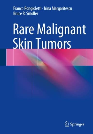 Image of - Rare Malignant Skin Tumors | Hardcover