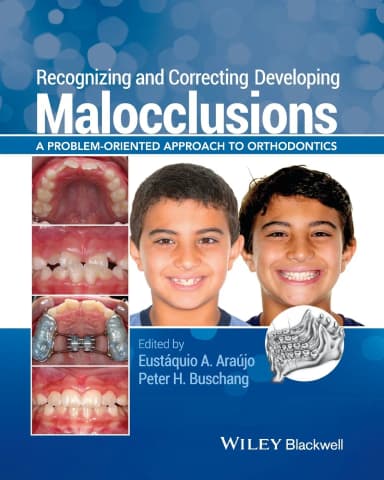 Image of - Recognizing and Correcting Developing Malocclusions | Paperback