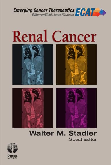 Image of - Renal Cancer | Hardcover