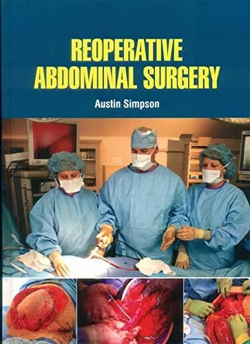 Image of - Reoperative Abdominal Surgery | Hardcover