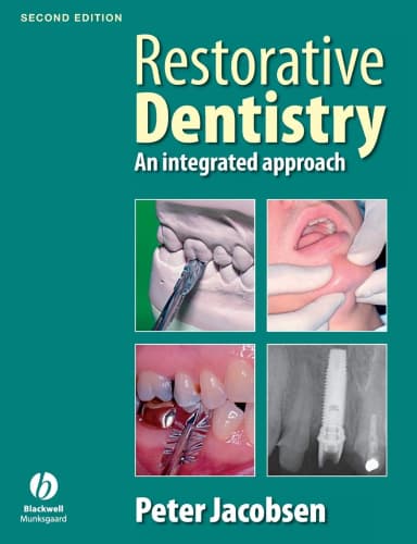 Image of - Restorative Dentistry An Integrated Approach | 2nd Edition | Paperback