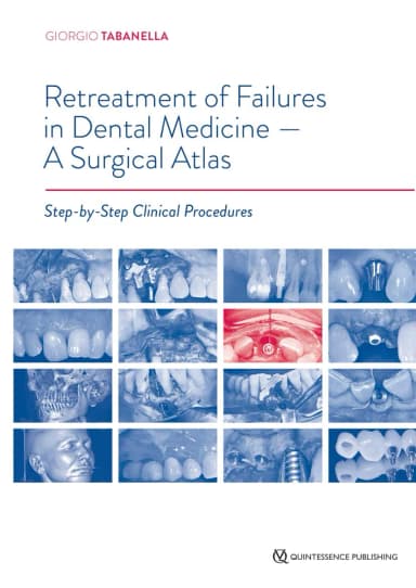 Image of - Retreatment of Failures in Dental Medicine- A Surgical Atlas | Hardcover