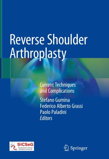 Image of - Reverse Shoulder Arthroplasty | Hardcover