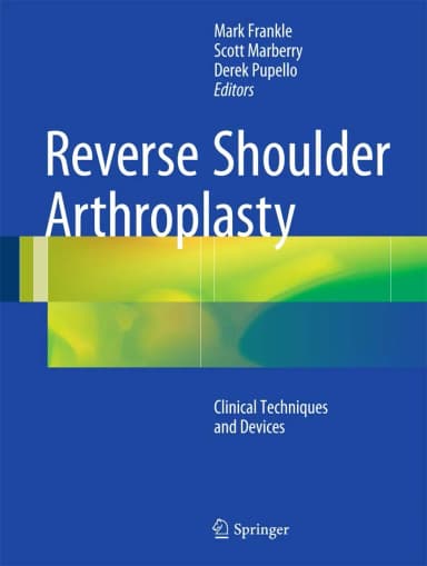 Image of - Reverse Shoulder Arthroplasty | Hardcover