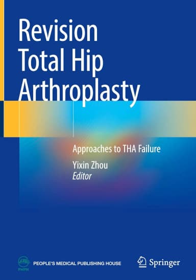 Image of - Revision Total Hip Arthroplasty Approaches To Tha Failure | Hardcover