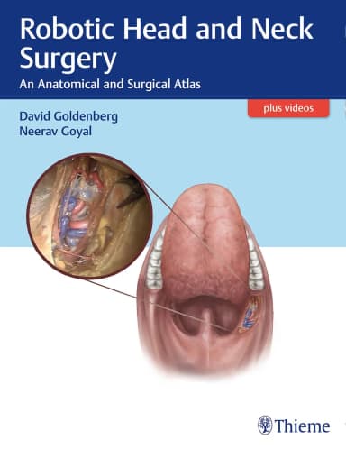 Image of - Robotic Head and Neck Surgery | Paperback