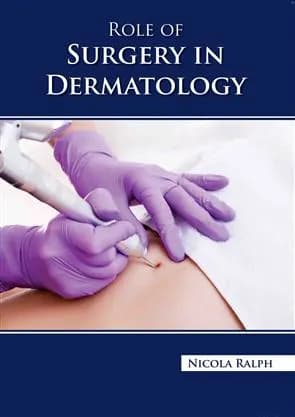 Image of - Role Of Surgery In Dermatology | Hardcover