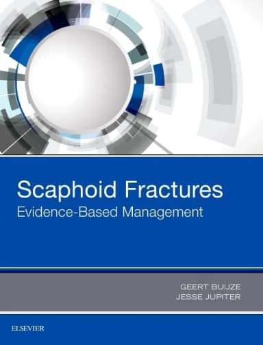 Image of - Scaphoid Fractures Evidence-Based Management | Hardcover