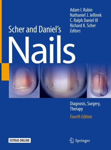 Image of - Scher and Daniel's Nails Diagnosis | Surgery | Therapy | 4th Edition | Hardcover