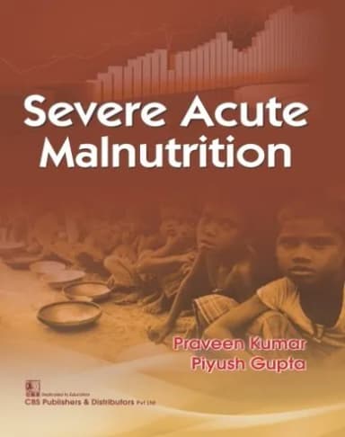 Image of - Severe Acute Malnutrition | Paperback