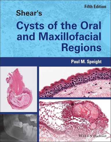Image of - Shears Cysts Of The Oral And Maxillofacial Regions 5th Edition | Hardcover