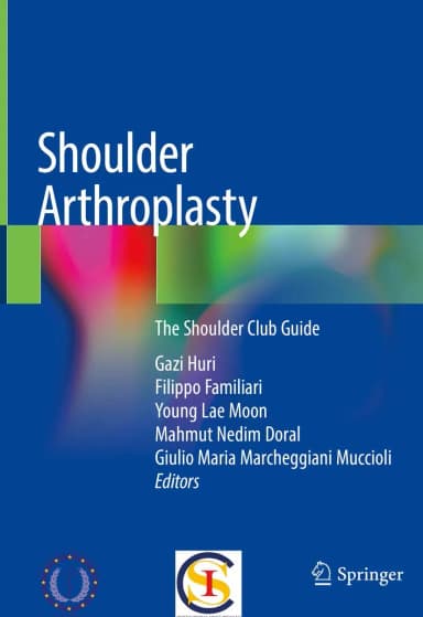 Image of - Shoulder Arthroplasty The Shoulder Club Guide | Hardcover