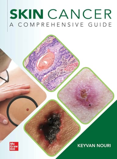 Image of - Skin Cancer A Comprehensive Guide | Hardcover