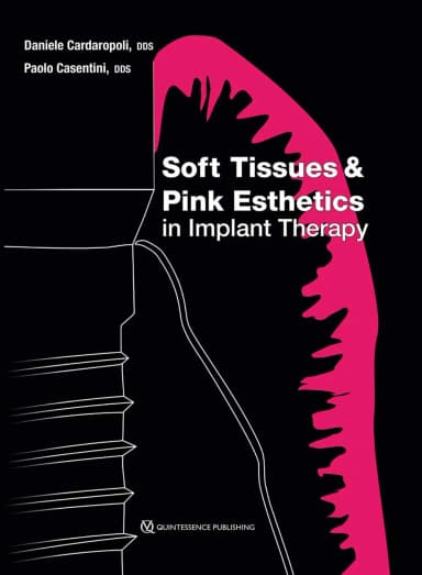 Image of - Soft Tissues and Pink Esthetics in Implant Therapy | Hardcover