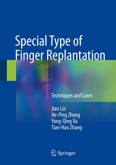 Image of - Special Type of Finger Replantation | Hardcover