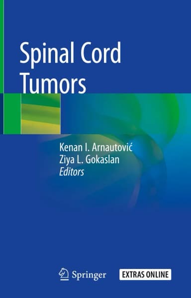Image of - Spinal Cord Tumors | Hardcover