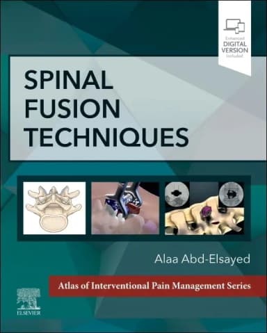 Image of - Spinal Fusion Techniques With Access Code | Hardcover