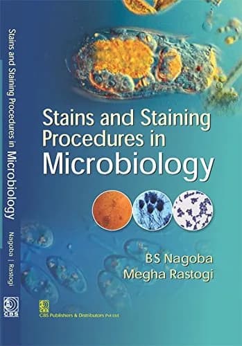 Image of - Stains and Staining Procedures in Microbiology