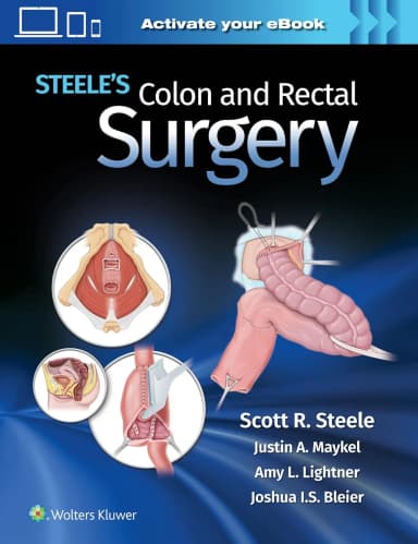 Image of - Steeles Colon And Rectal Surgery With Access Code | Hardcover