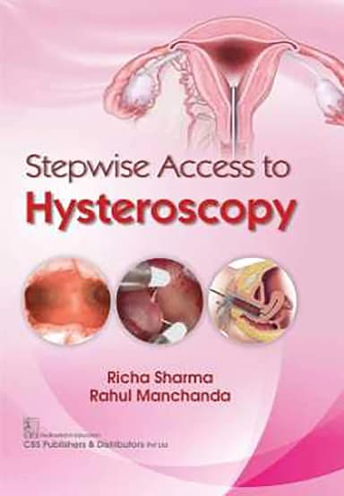 Image of - Stepwise Access to Hysteroscopy | Hardcover
