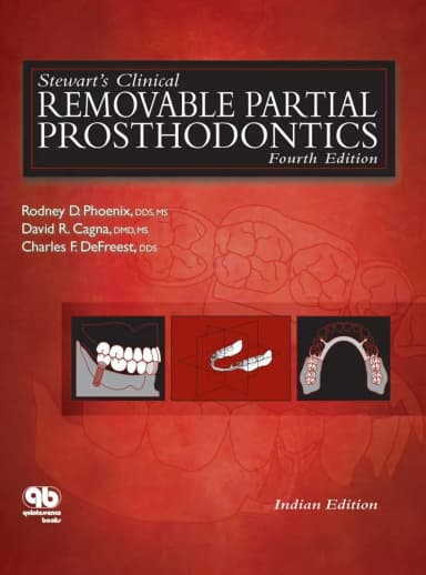 Image of - Stewarts Clinical Removable Partial Prosthodontics 4th Edition | Hardcover