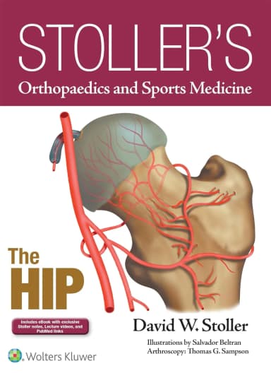 Image of - Stoller's Orthopaedics and Sports Medicine The Hip | Hardcover