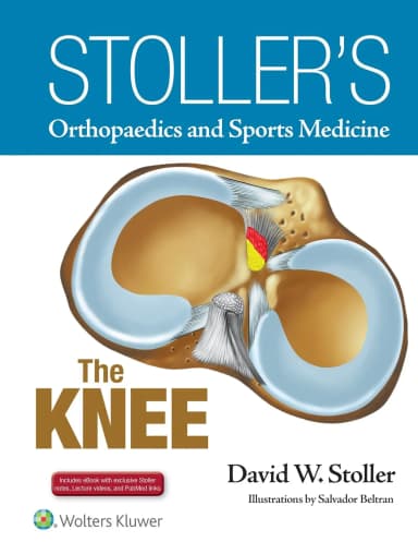 Image of - Stoller's Orthopaedics and Sports Medicine The Knee | Hardcover