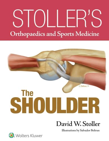Image of - Stoller's Orthopaedics and Sports Medicine The Shoulder | Hardcover
