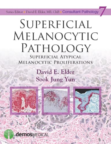 Image of - Superficial Melanocytic Pathology | Hardcover