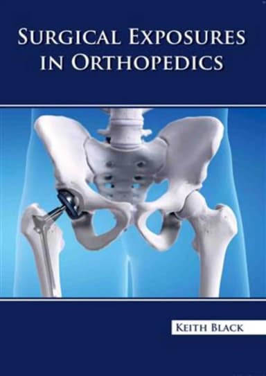 Image of - Surgical Exposures In Orthopedics | Hardcover