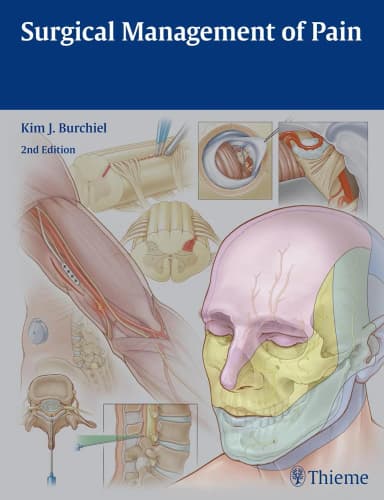 Image of - Surgical Management of Pain | Hardcover