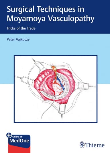 Image of - Surgical Techniques in Moyamoya Vasculopathy | Hardcover