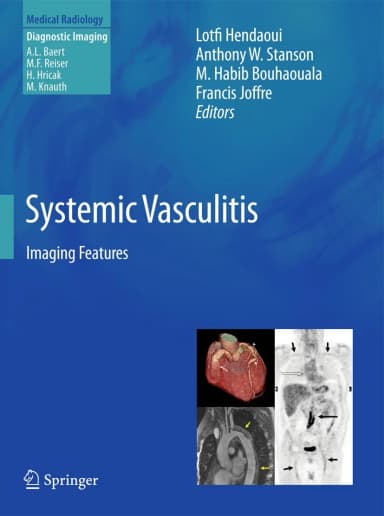 Image of - Systemic Vasculitis | Hardcover