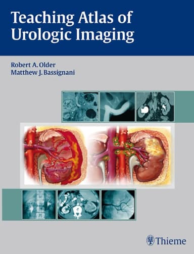 Image of - Teaching Atlas of Urologic Imaging | Hardcover
