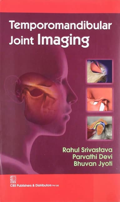 Image of - Temporomandibular Joint Imaging | Paperback