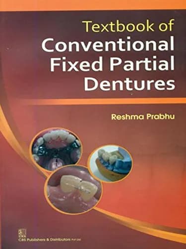 Image of - Textbook of Conventional Fixed Partial Dentures
