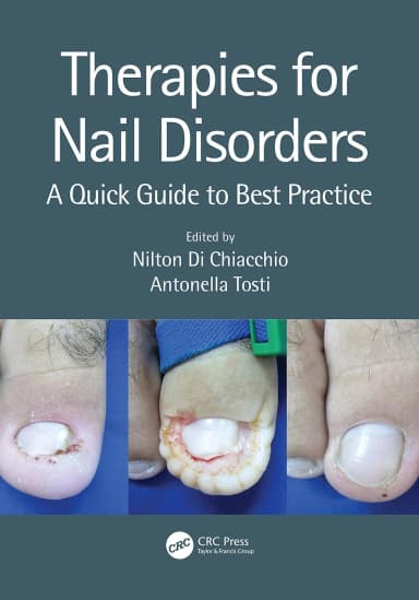 Image of - Therapies For Nail Disorders A Quick Guide To Best Practice | Paperback