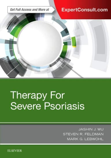 Image of - Therapy for Severe Psoriasis | Hardcover